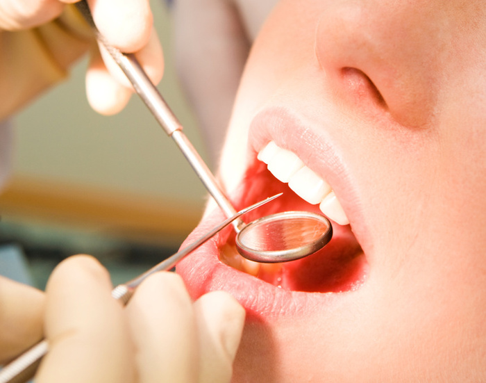 How to Prepare for Oral Surgery in Chanhassen, MN