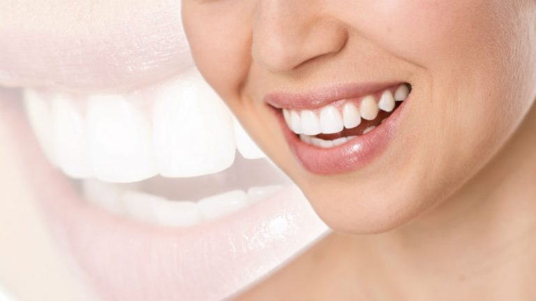 Visiting Your Local Dental Office in Macon, GA