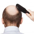 Hair Restoration New York City? Speak with Feller & Bloxham Medical