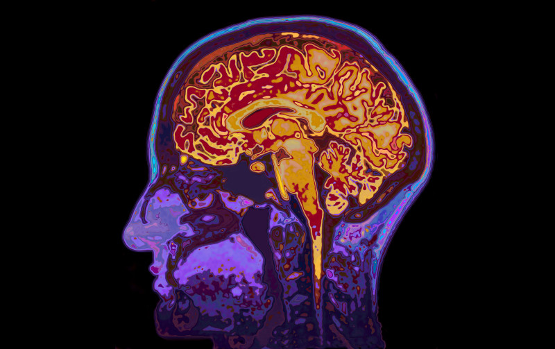 Pediatric Neurologists in New Jersey Treat Nervous System Disorders