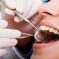What to Expect When You Visit a Cosmetic Dentist in Chanhassen, MN