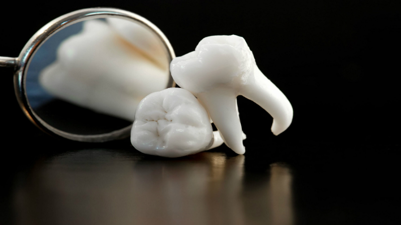 Signs You Need a Dentist in Manassas, Virginia