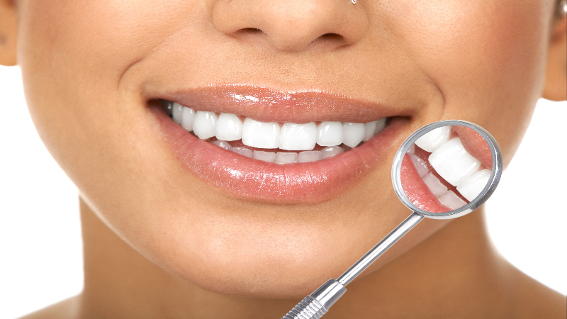 How to Find the Best Teeth Whitening in Macon, GA