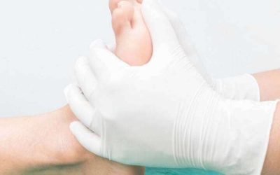 Why You Shouldn’t Ignore That Ingrown Toenail