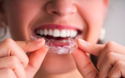 Improve Your Smile Confidence With Invisalign In Round Rock TX From Local Experts