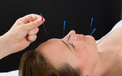 Improve Your Wellbeing Through Holistic Healing Using Acupuncture Therapy in Newark, CA